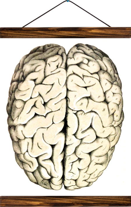Human brain, reprint on linen - Josef und Josefine