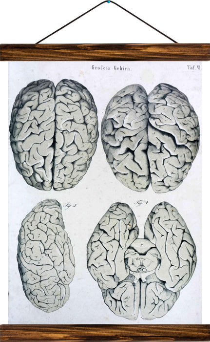 Human brain, reprint on linen - Josef und Josefine