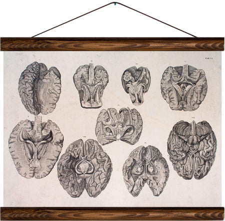 Human brain, reprint on linen - Josef und Josefine